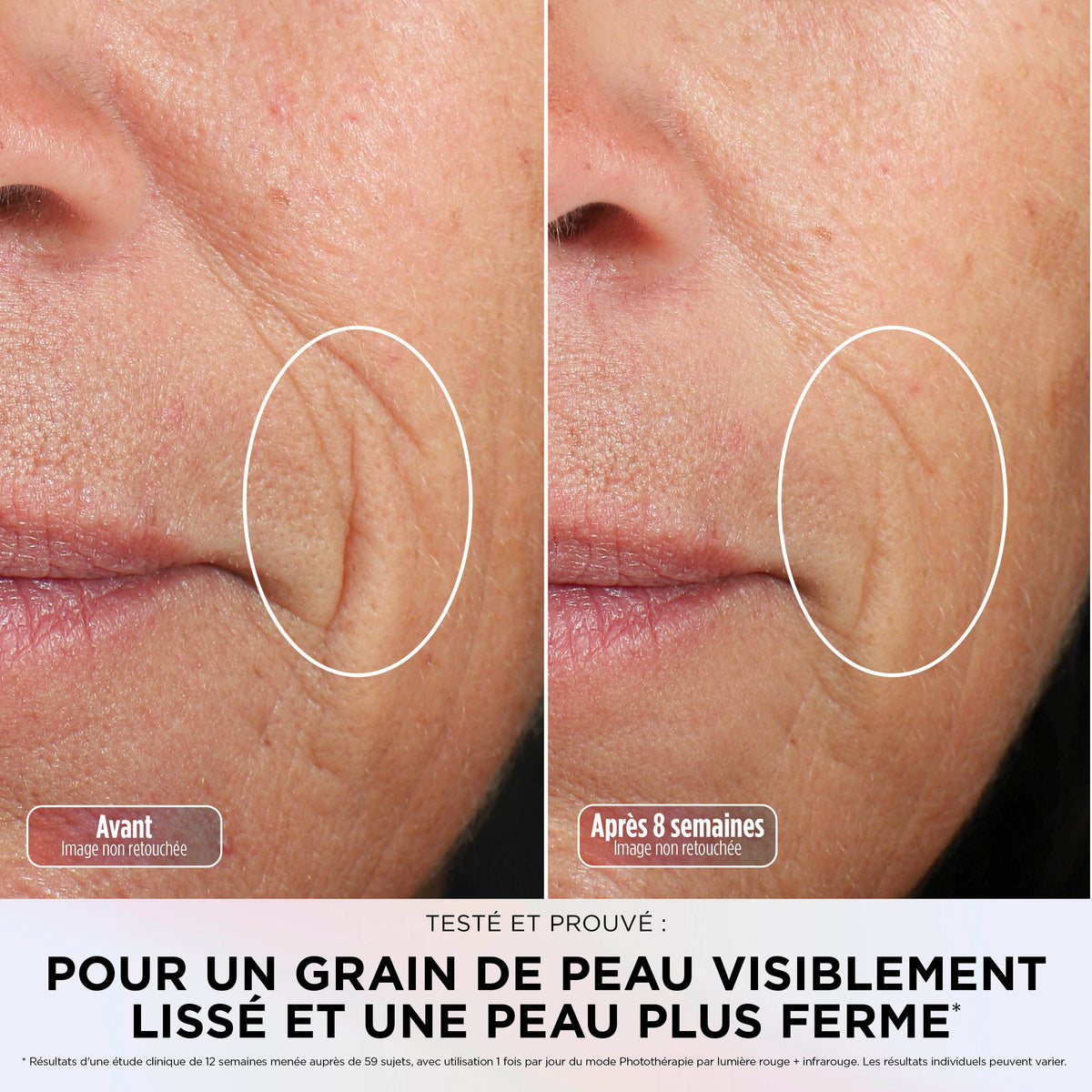 Masque LED Shark CryoGlow avec rafraîchissement du contour des yeux - Lilas doux