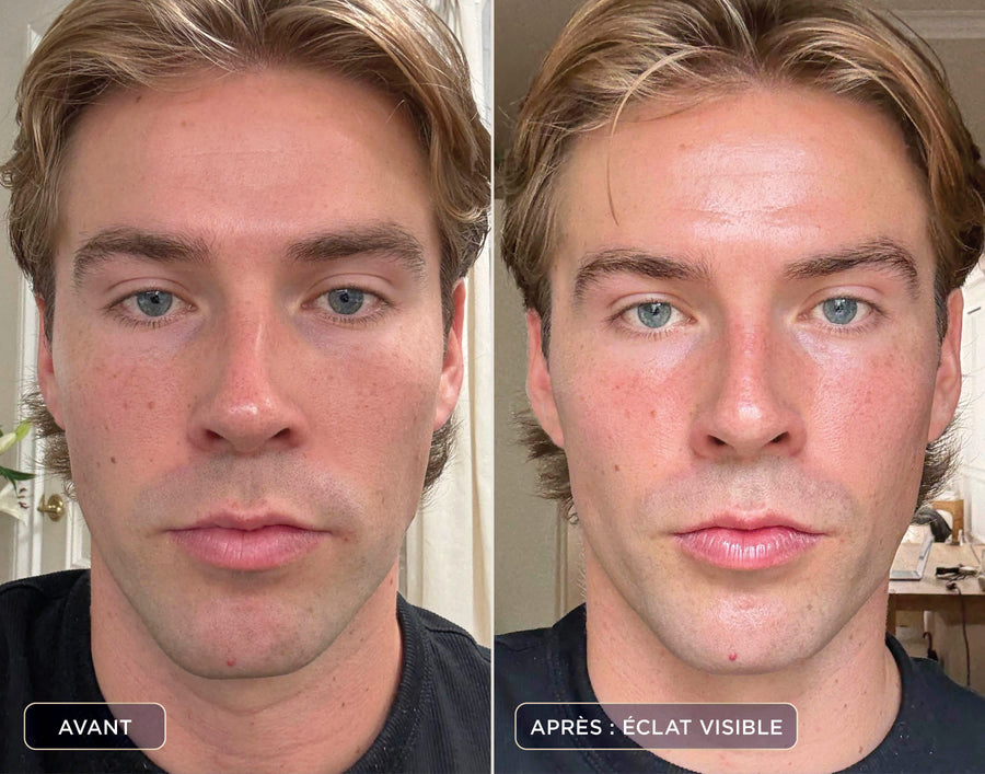 Masque LED CryoGlow + Appareil de soin FacialPro Glow + DePuffi - Bleu